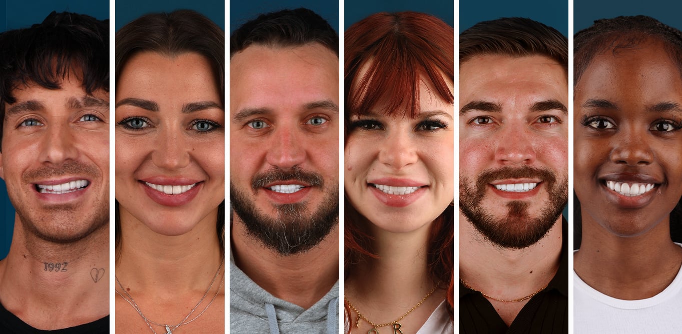 Dental Aesthetics 2023 in turkey